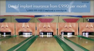 Dental_implant